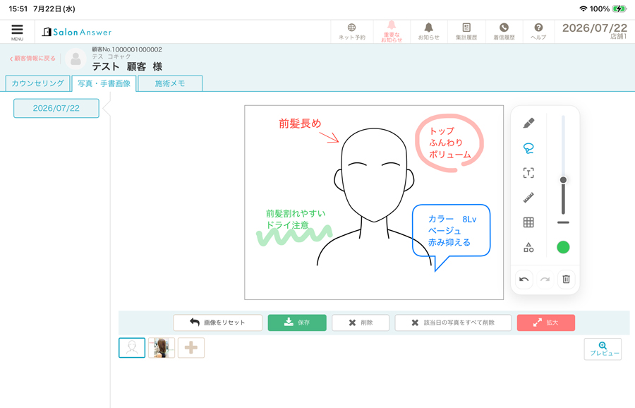 カルテ画面